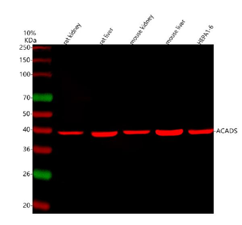 ACADS/SCAD Rabbit Polyclonal Antibody