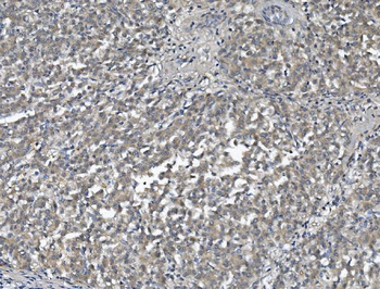 AFM Rabbit Polyclonal Antibody
