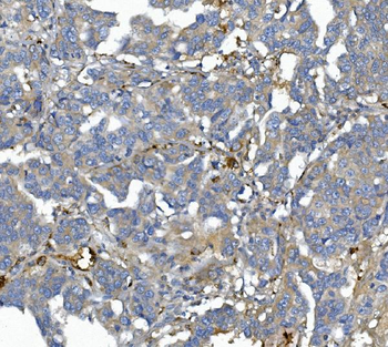 AFM Rabbit Polyclonal Antibody