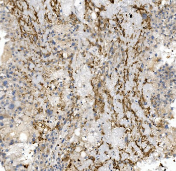 CCR2 Rabbit Polyclonal Antibody