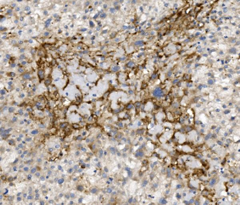 CCR2 Rabbit Polyclonal Antibody