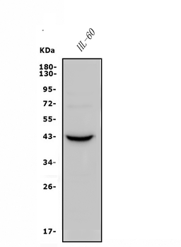 CCR2 Rabbit Polyclonal Antibody