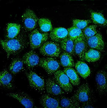 CD38 Rabbit Polyclonal Antibody