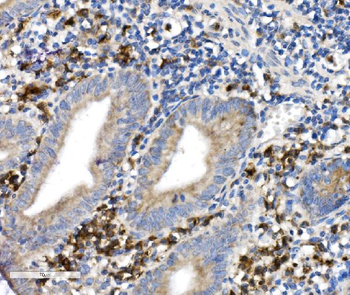 CD38 Rabbit Polyclonal Antibody
