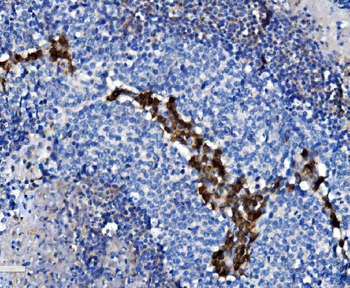 CD38 Rabbit Polyclonal Antibody