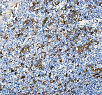 CD38 Rabbit Polyclonal Antibody