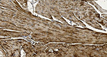 Alpha B Crystallin/CRYAB Rabbit Polyclonal Antibody