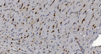 Alpha B Crystallin/CRYAB Rabbit Polyclonal Antibody