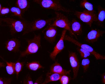 Alpha B Crystallin/CRYAB Rabbit Polyclonal Antibody