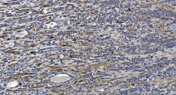 Alpha B Crystallin/CRYAB Rabbit Polyclonal Antibody