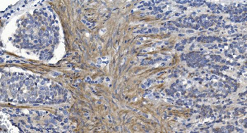 Alpha B Crystallin/CRYAB Rabbit Polyclonal Antibody