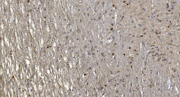 Alpha B Crystallin/CRYAB Rabbit Polyclonal Antibody