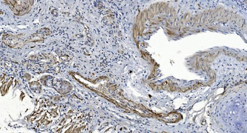 Alpha B Crystallin/CRYAB Rabbit Polyclonal Antibody