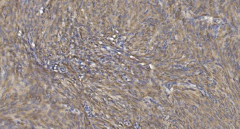 Alpha B Crystallin/CRYAB Rabbit Polyclonal Antibody