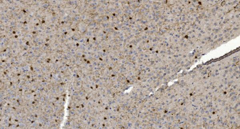 Alpha B Crystallin/CRYAB Rabbit Polyclonal Antibody