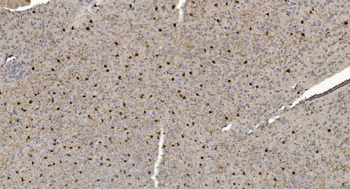 Alpha B Crystallin/CRYAB Rabbit Polyclonal Antibody