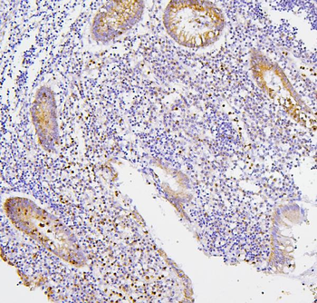 CXCR2 Rabbit Polyclonal Antibody
