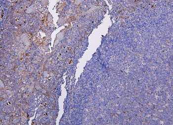 CXCR2 Rabbit Polyclonal Antibody