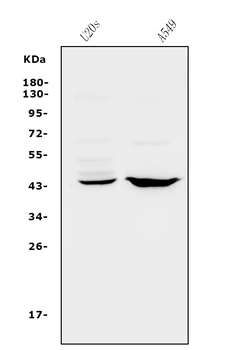 CXCR2 Rabbit Polyclonal Antibody