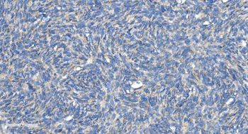 DRP1/DNM1L Rabbit Polyclonal Antibody