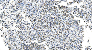 DRP1/DNM1L Rabbit Polyclonal Antibody