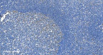 DRP1/DNM1L Rabbit Polyclonal Antibody