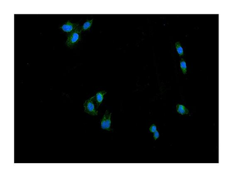 DRP1/DNM1L Rabbit Polyclonal Antibody