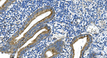 DRP1/DNM1L Rabbit Polyclonal Antibody