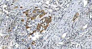 DRP1/DNM1L Rabbit Polyclonal Antibody