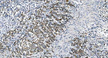DRP1/DNM1L Rabbit Polyclonal Antibody