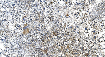 DRP1/DNM1L Rabbit Polyclonal Antibody
