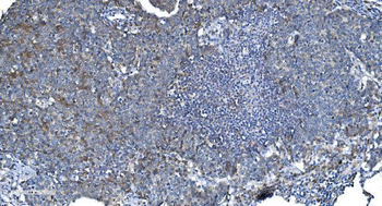 DRP1/DNM1L Rabbit Polyclonal Antibody