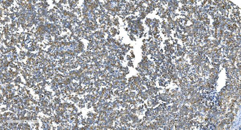 DRP1/DNM1L Rabbit Polyclonal Antibody