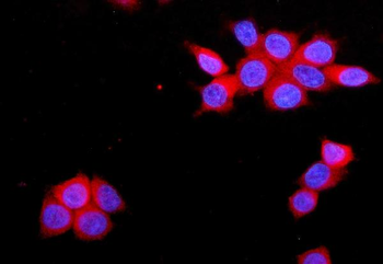 JAM-A/F11R/JAM Rabbit Polyclonal Antibody