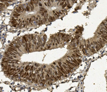 FOXP1 Rabbit Polyclonal Antibody