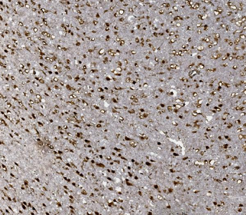 FOXP1 Rabbit Polyclonal Antibody