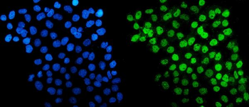HDAC5 Rabbit Polyclonal Antibody