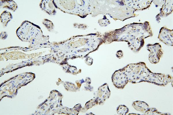 HDAC5 Rabbit Polyclonal Antibody