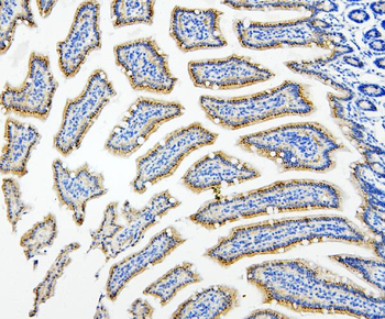 HDAC5 Rabbit Polyclonal Antibody