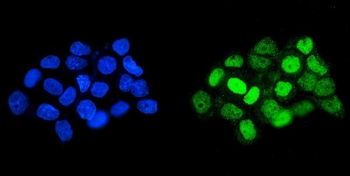 HOXD11 Rabbit Polyclonal Antibody