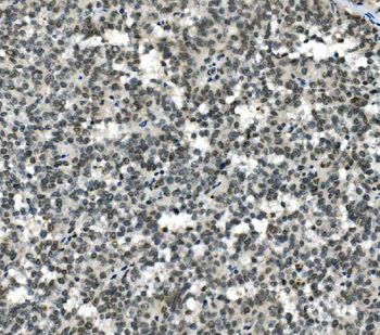 HOXD11 Rabbit Polyclonal Antibody