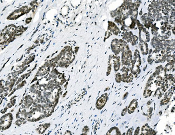 HOXD11 Rabbit Polyclonal Antibody