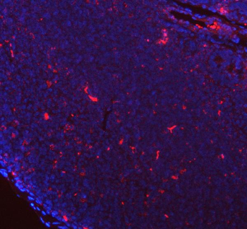 GILT/IFI30 Rabbit Polyclonal Antibody
