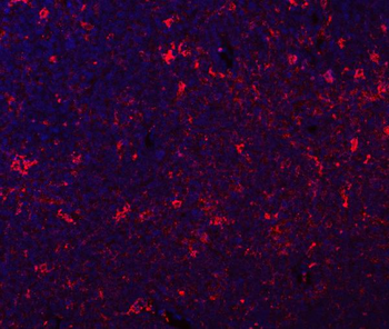 GILT/IFI30 Rabbit Polyclonal Antibody