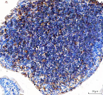 GILT/IFI30 Rabbit Polyclonal Antibody