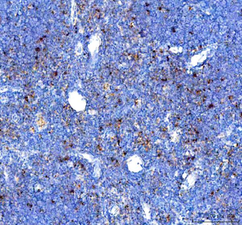 GILT/IFI30 Rabbit Polyclonal Antibody