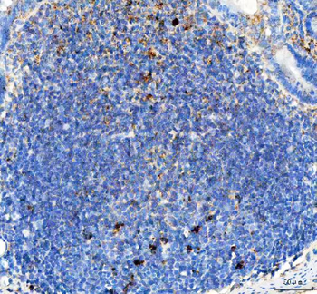 GILT/IFI30 Rabbit Polyclonal Antibody