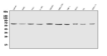 IL2 Receptor gamma/IL2RG Rabbit Polyclonal Antibody