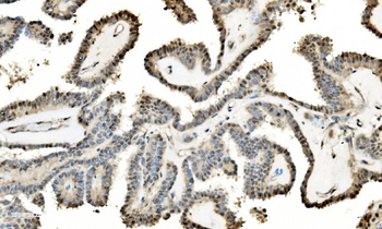 LSM2 Rabbit Polyclonal Antibody