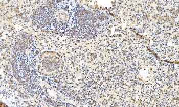 LSM2 Rabbit Polyclonal Antibody